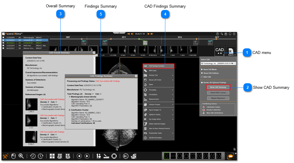 10.2.0. CAD Summary