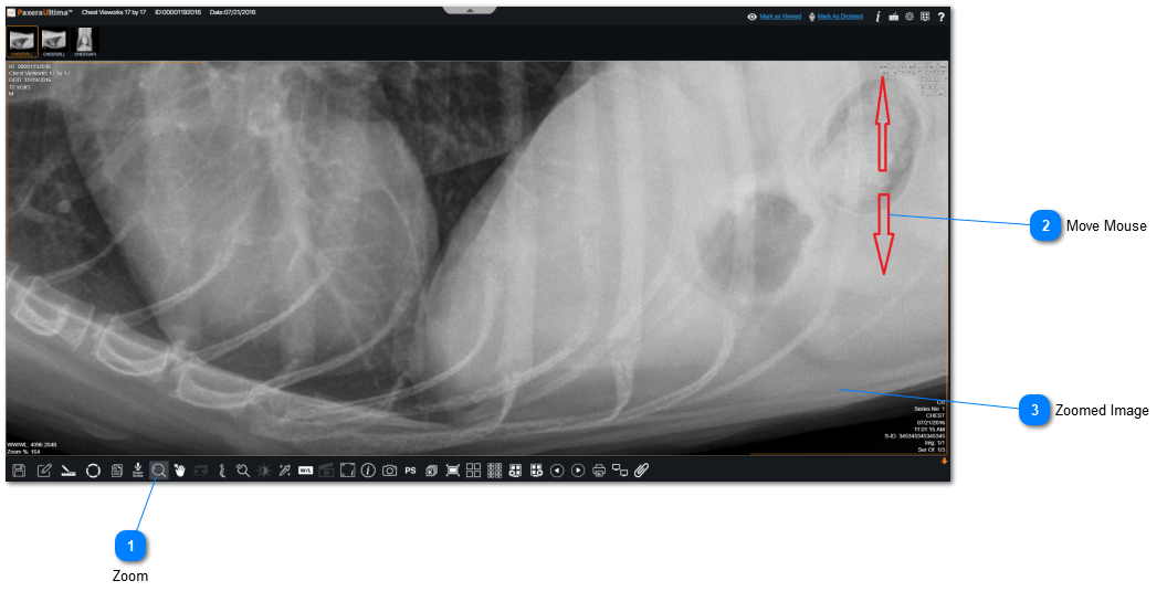17.2.5.3. Zoom