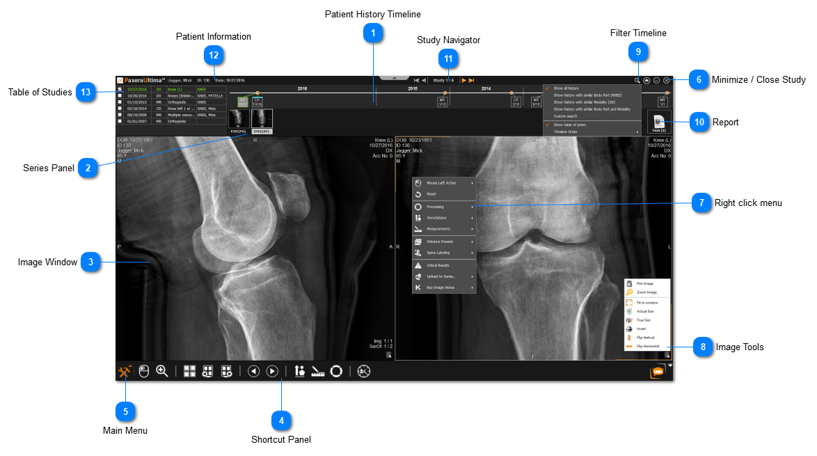 2.2.2. Study Viewer