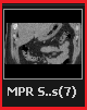 5. MPR Series